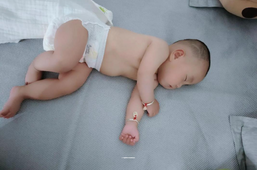 襄垣宝宝头上长痱子